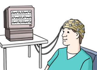 Bild eines EEG